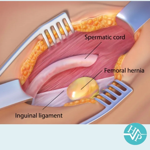 HSP  Harley Surgical Practice